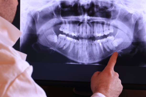 Best Emergency Tooth Extraction in Warrenton, VA