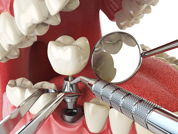 Best Emergency TMJ Treatment in Warrenton, VA